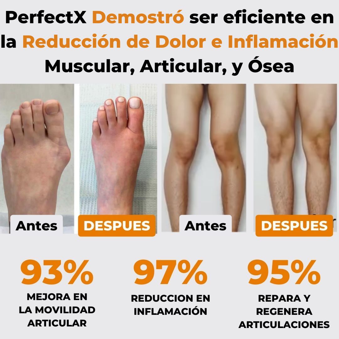 PerfectX™ | Compra 1 y te regalamos la 2